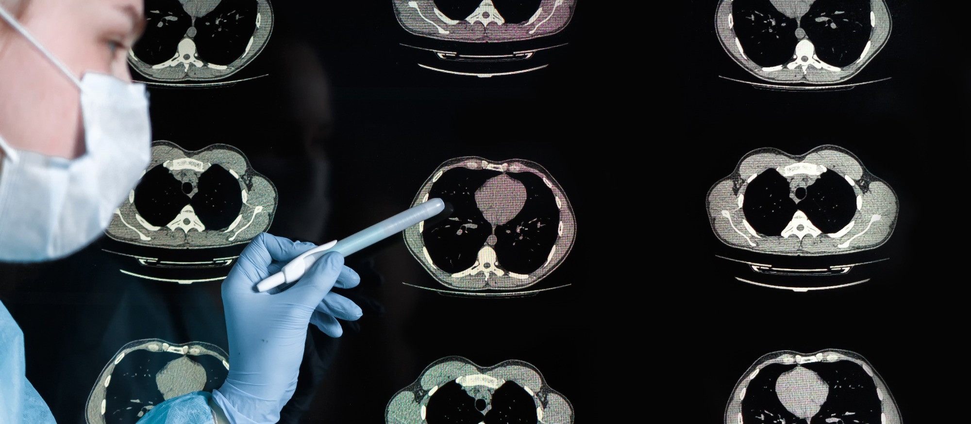 Study: Brain imaging and neuropsychological assessment of individuals recovered from mild to moderate SARS-CoV-2 infection. Image Credit: Shyntartanya / Shutterstock