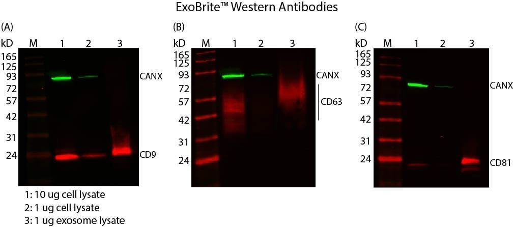 Figure 2. Figure 2. Western detection using ExoBrite™ Western Antibodies and MCF-7 cell and exosome lysates, showing tetraspanin protein enrichment and calnexin depletion in exosomes. Blots were stained with ExoBrite™ 770/800 Calnexin Antibody (exosome negative control) plus (A) ExoBrite™ 680/700 CD9 Antibody, (B) ExoBrite™ 680/700 CD63 Antibody, or (C) ExoBrite™ 680/700 CD81 Antibody. Lane M: Protein marker. Lane 1: 10 ug cell lysate. Lane 2: 1 ug cell lysate. Lane 3: 1 ug exosome lysate. The blots were imaged on a LI-COR Odyssey® infrared imaging system.