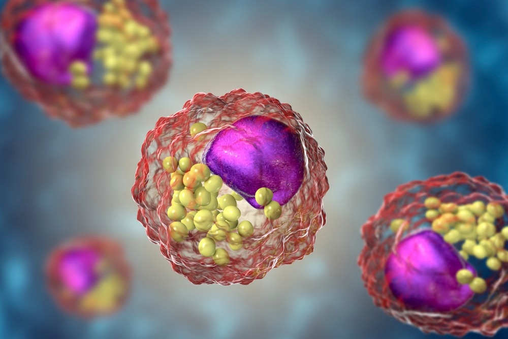 Study: In vitro review of nanoparticles attacking macrophages: Interaction and cell death. Image Credit: Kateryna Kon / Shutterstock.com