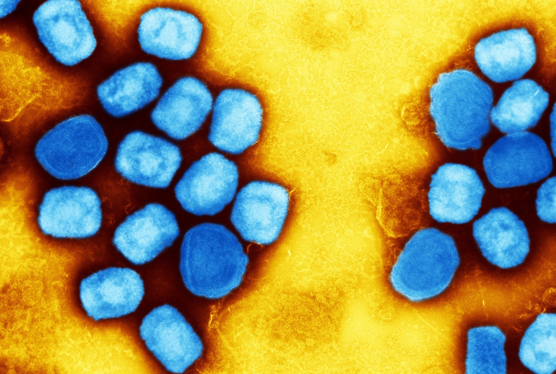 Two Cases of Monkeypox-Associated Encephalomyelitis — Colorado and the District of Columbia, July–August 2022. Image Credit: NIAID