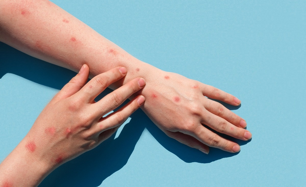 Study: Viable Monkeypox virus in the environment of a patient room. Image Credit: Marina Demidiuk/Shutterstock