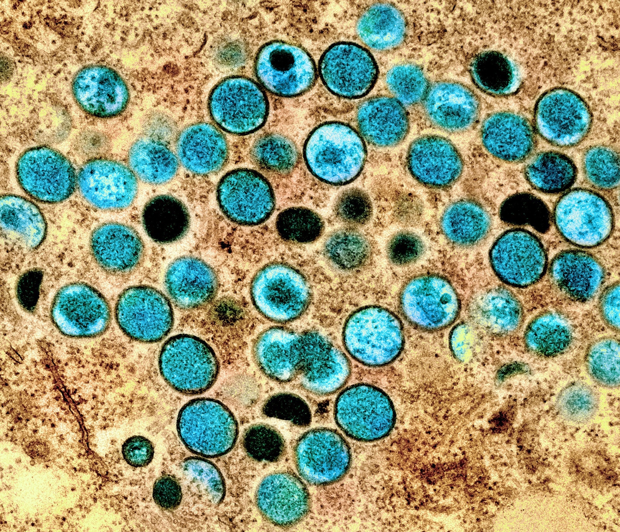 Study: Epidemiologic Features of the Monkeypox Outbreak and the Public Health Response — United States, May 17–October 6, 2022. Image Credit: NIAID