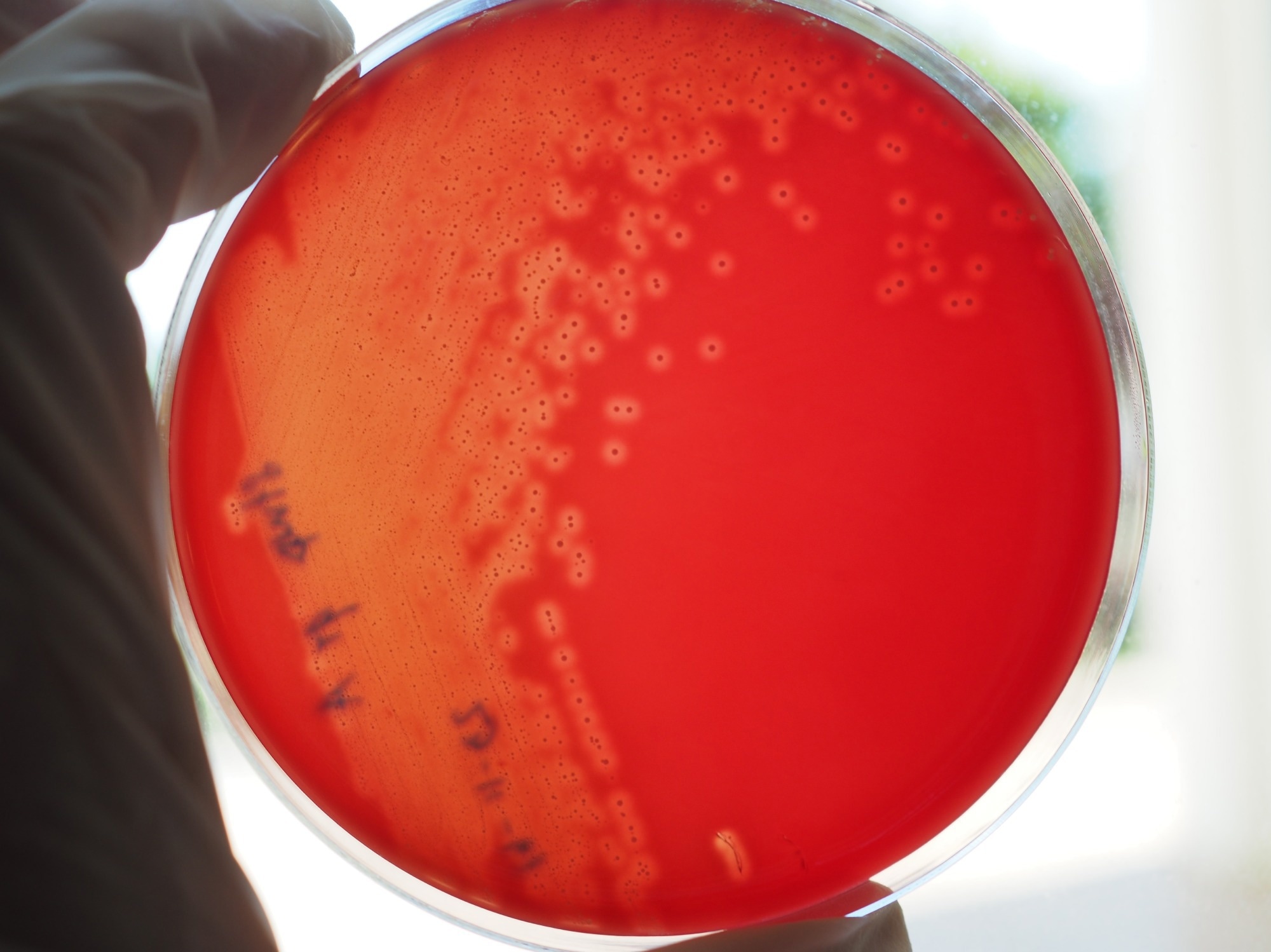 Study: Group a streptococcal (GAS) infections amongst children in Europe: taming the rising tide. Image Credit: MyFavoriteTime / Shutterstock