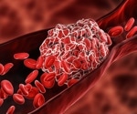 Review on nanoparticles usage for treating thrombosis induced by SARS-CoV-2 infections