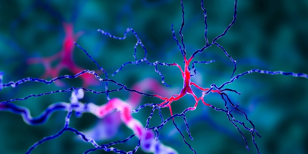 Study: Extending genetic risk for Alzheimer’s disease from host to holobiont. Image Credit: Kateryna Kon/Shutterstock