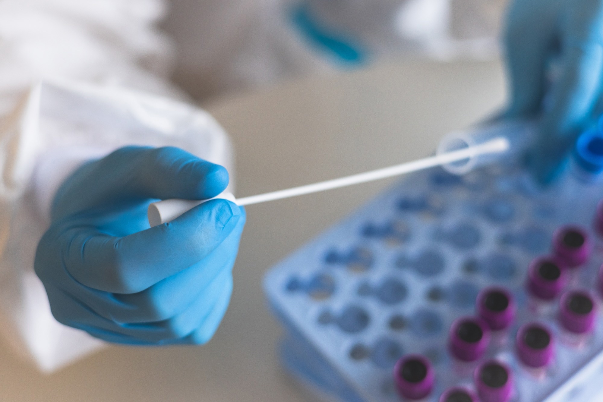 Study: A spike-targeting bispecific T cell engager strategy provides dual layer protection against SARS-CoV-2 infection in vivo. Image Credit: Tsuguliev/Shutterstock.com