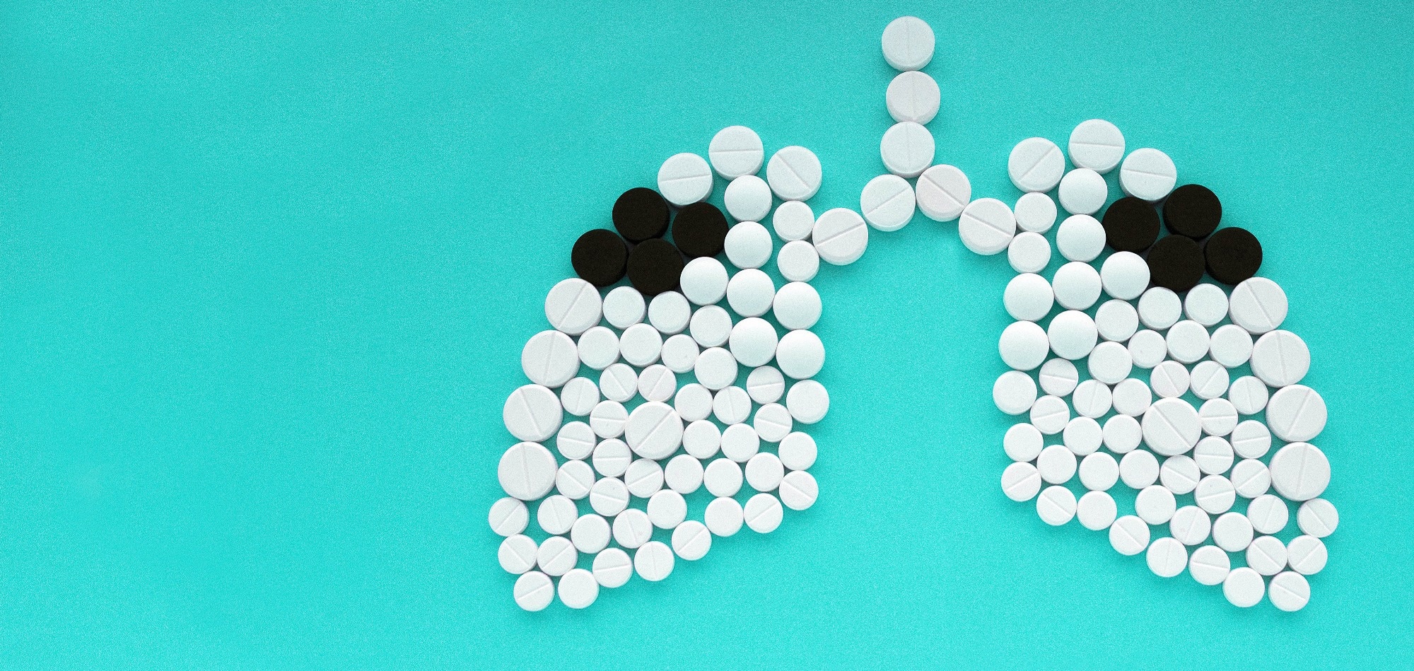 Study: Global treatment outcomes of extensively drug-resistant tuberculosis in adults: A systematic review and meta-analysis. Image Credit: LiliiaLysenko/Shutterstock.com