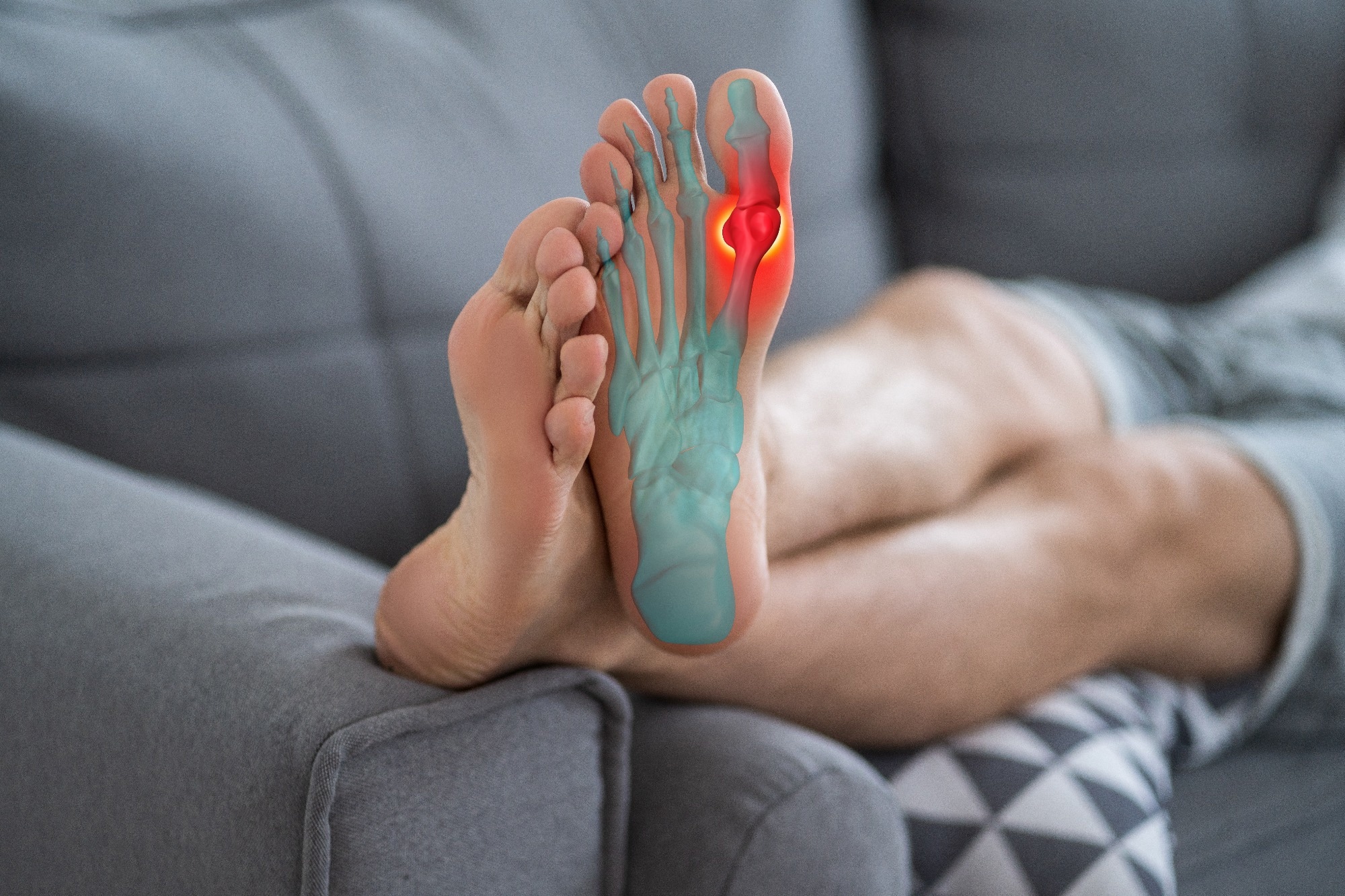 Study: Causal Relationship between Gut Microbiota and Gout: A Two-Sample Mendelian Randomization Study. Image Credit: staras / Shutterstock