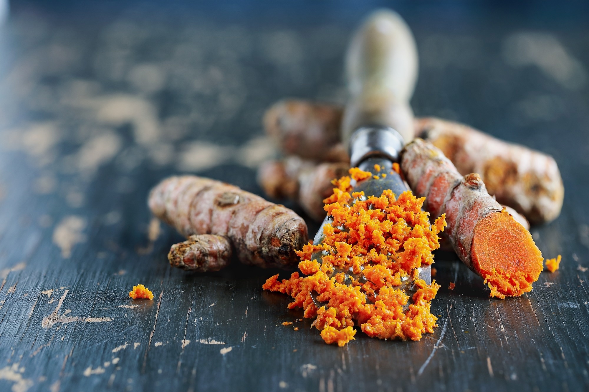 Study: Curcumin enhances elvitegravir concentration and alleviates oxidative stress and inflammatory response. Image Credit: Stephanie Frey / Shutterstock