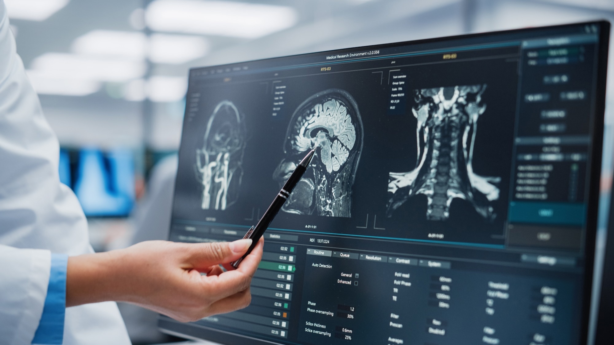 Study: Trends in Intracranial and Cerebral Volumes of Framingham Heart Study Participants Born 1930 to 1970. Image Credit: Gorodenkoff/Shutterstock.com