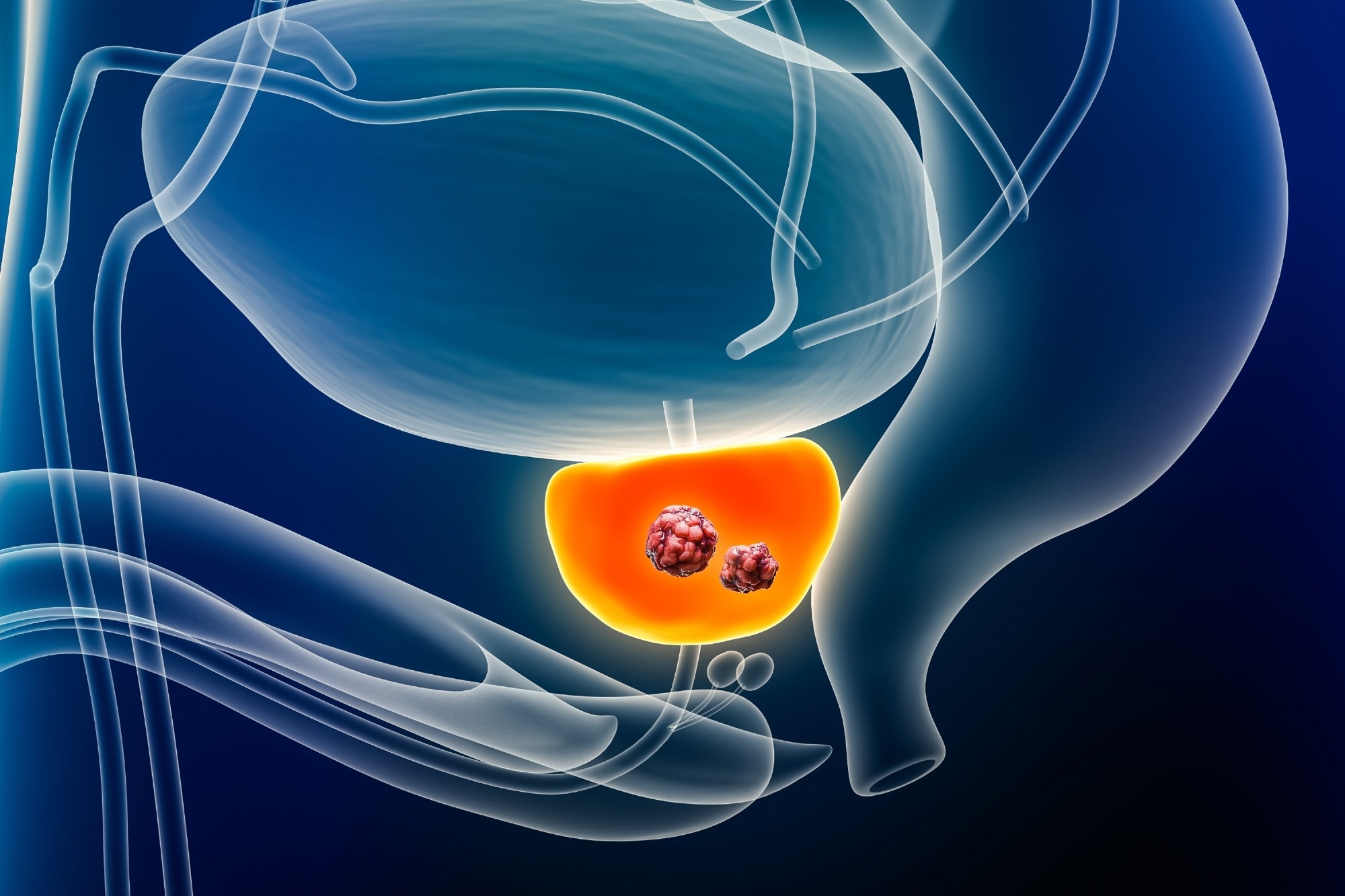 Perspective: Unlocking ferroptosis in prostate cancer — the road to novel therapies and imaging markers. Image Credit: MattL_Images / Shutterstock