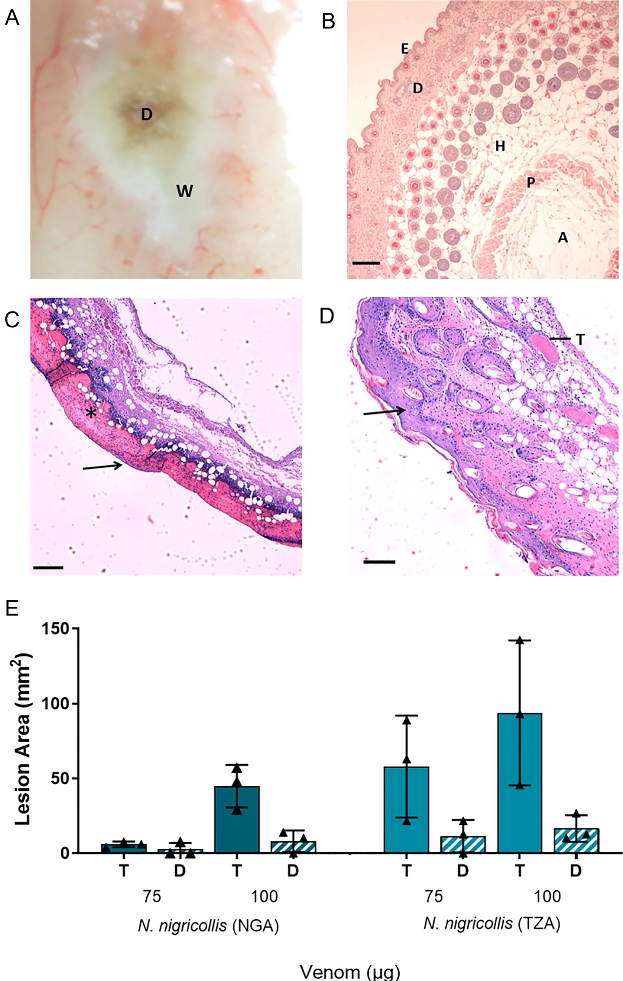 African spitting cobra venoms cause heterogenous dermonecrotic lesions in vivo. Groups of mice (n = 3) were injected intradermally with two doses of spitting cobra venom and after 72 h the resulting lesions were excised for macroscopic quantification of damaged areas and histological assessment. (A) Representative macroscopic image of a skin lesion induced by 100 µg of venom from West African (Nigeria) N. nigricollis, in which a dark central area (D) of necrosis is observed surrounded by a white area (W) of skin damage. (B–D) Representative light micrographs of sections of the skin of mice injected with PBS or West African N. nigricollis venom. (B) Skin injected with PBS showed a normal histological appearance including the epidermis (E), dermis (D), hypodermis (H), panniculus carnosus (P) and adventitia (A). (C) Light micrograph of a section of skin corresponding to a dark area of venom-induced damage. All skin layers were affected, with loss of epidermis (arrow) and skin appendages in the dermis. A proteinaceous hyaline material was observed (*). (D) Light micrograph of a section of the skin corresponding to a white area of damage from a mouse injected with venom. There was an increase in the thickness of epidermis (hyperplasia; arrow) and inflammatory infiltrate in the dermis. Thrombi (T) were observed in some blood vessels. (E) The area of dermonecrotic lesions caused by N. nigricollis (West African, Nigeria [NGA]; East African, Tanzania [TZA]) venoms at different doses. Bars show the mean area of the total lesions (T) in comparison to the dark central areas (D) of greatest intensity, and error bars represent the SD from the mean. Scale bar in (B–D) represent 100 µm.