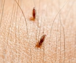 Study finds human body lice can transmit plague bacteria