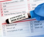 Differing definitions of iron deficiency lead to divergent estimates of prevalence, study finds