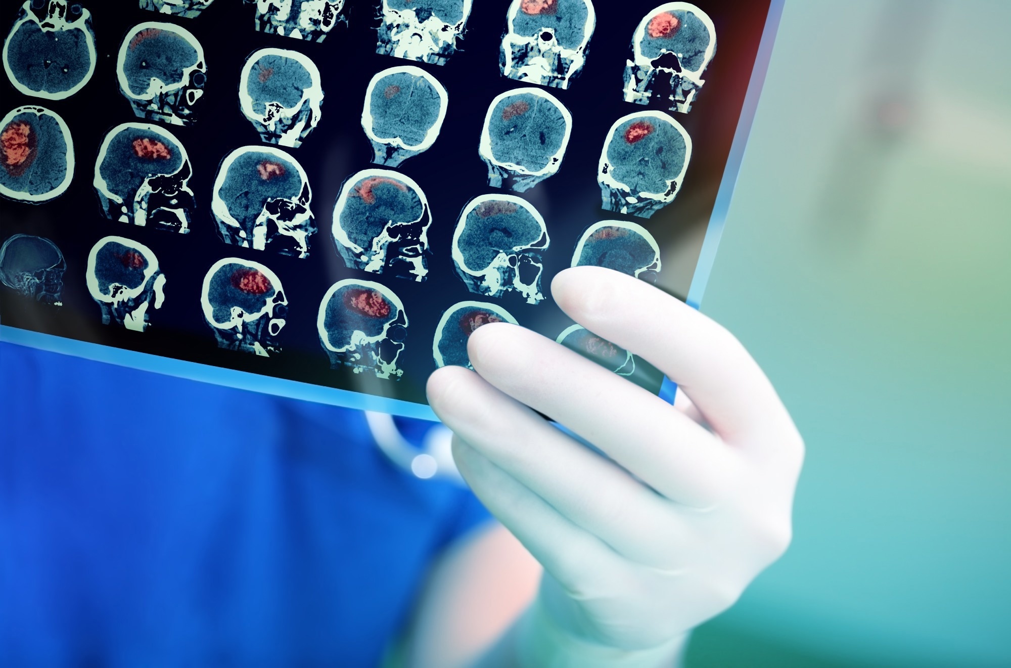Review: Identifying and reducing risks of neurological complications associated with vaccination. Image Credit: sfam_photo / Shutterstock