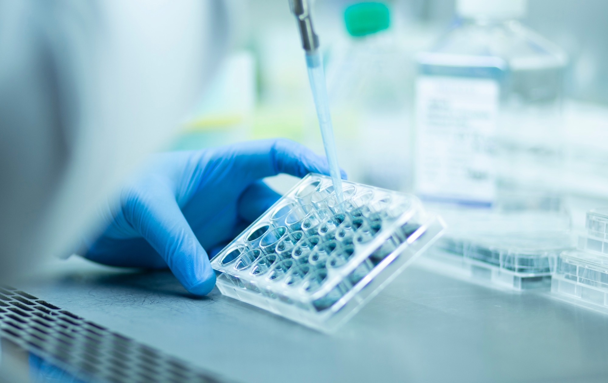 Study: Differentiation of Prior SARS-CoV-2 Infection and Postacute Sequelae by Standard Clinical Laboratory Measurements in the RECOVER Cohort. Image Credit: murat photographer / Shutterstock