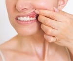 Gum disease tied to higher thrombosis risk: Could periodontal therapy help save lives?