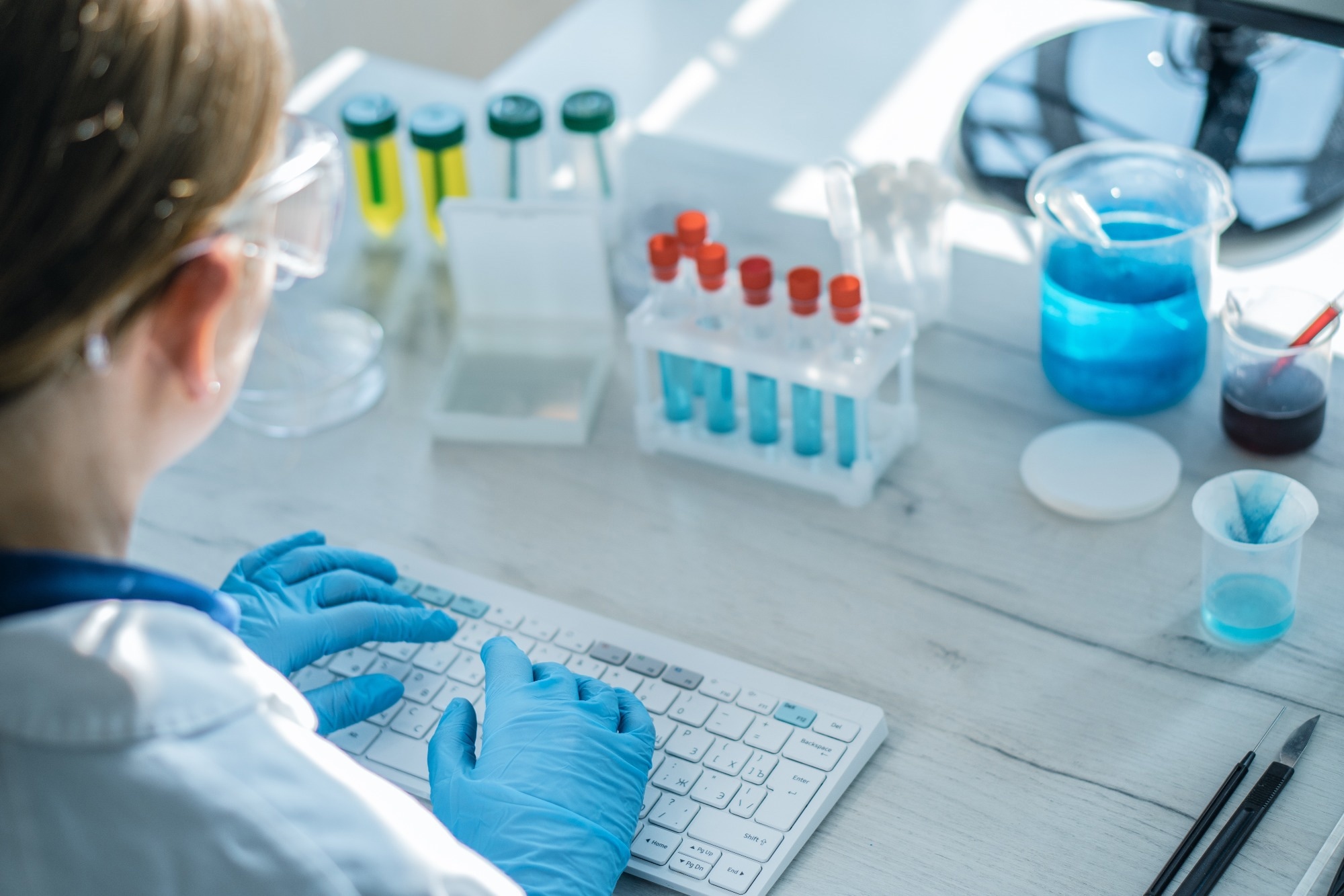 Study: Carbonic anhydrase inhibition ameliorates tau toxicity via enhanced tau secretion. Image Credit: YURIMA/Shutterstock.com