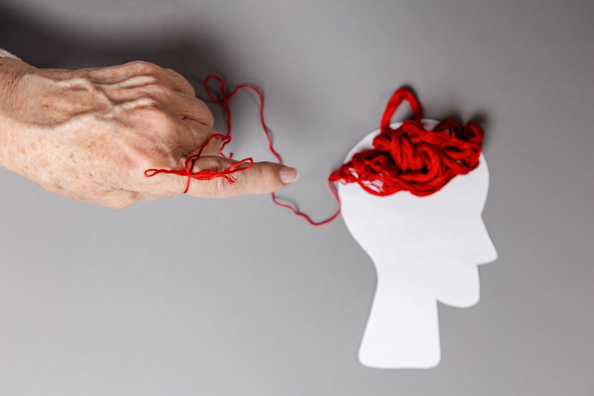 Study: Prediction and clustering of Alzheimer’s disease by race and sex: a multi-head deep-learning approach to analyze irregular and heterogeneous data. Image Credit: STEKLO / Shutterstock