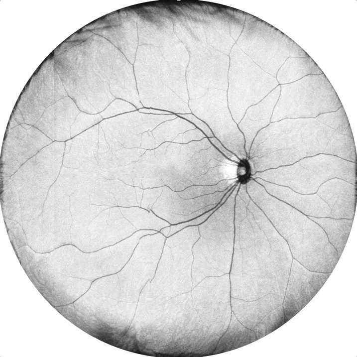 The evolution of OCT for retinal imaging and disease intervention