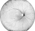 The evolution of OCT for retinal imaging and disease intervention