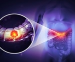 Vitamin D curbs colorectal cancer by boosting immunity and blocking tumor growth