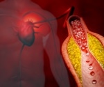 Coronary inflammation marker helps identify hidden heart risk in young adults