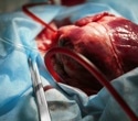 Breakthrough soft robotics could redefine artificial heart technology