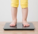 Extreme childhood obesity drives liver and diabetes risks