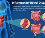 Western diet fuels IBD by derailing the microbiome - can precision nutrition turn the tide?