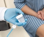 New federal guidelines shift cervical cancer screening to HPV testing