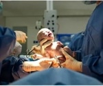 Researchers develop new method for predicting the risk of birth injuries