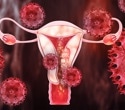 Digital biomarkers revolutionize early diagnosis of endometriosis and pelvic conditions