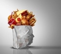 Experts call for bold policies to curb the health harms of ultra-processed foods