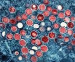 Global Virus Network accelerates mpox diagnostic research