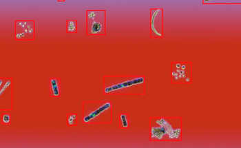Advanced Particle Analysis with FlowCam by Yokogawa Fluid Imaging Technologies