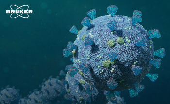 NMR based lipoprotein phenotyping can reveal recovery subgroups in SARS-CoV 2 infected patients