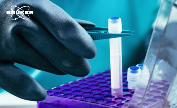 Evolving your biobank business model